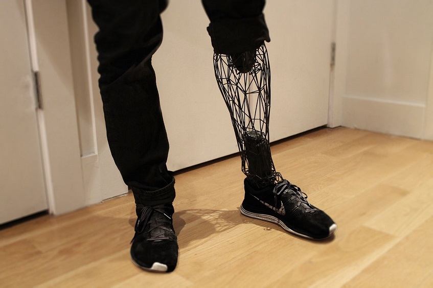3D Prosthetic Leg
